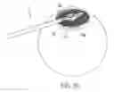 Fig. 22 - Circular thermal capsulotomy tool and system