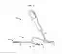 Fig. 02 - Intramedullary fixation screw, a fixation system, and method of fixation of the subtalar joint