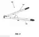 Fig. 11 - Intramedullary fixation screw, a fixation system, and method of fixation of the subtalar joint