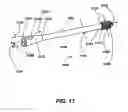 Fig. 13 - Intramedullary fixation screw, a fixation system, and method of fixation of the subtalar joint