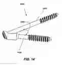Fig. 16 - Intramedullary fixation screw, a fixation system, and method of fixation of the subtalar joint