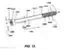 Fig. 17 - Intramedullary fixation screw, a fixation system, and method of fixation of the subtalar joint