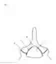 Fig. 02 - Surgical chisel