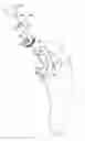 Fig. 01 - Reciprocating rasps for use in an orthopaedic surgical procedure