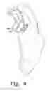 Fig. 06 - Reciprocating rasps for use in an orthopaedic surgical procedure
