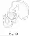 Fig. 22 - Reciprocating rasps for use in an orthopaedic surgical procedure