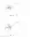 Fig. 07 - DELIVERY SYSTEMS AND METHODS FOR GASTRIC REDUCTION
