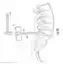 Fig. 08 - Guidewire and method for surgical procedures