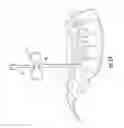 Fig. 09 - Guidewire and method for surgical procedures