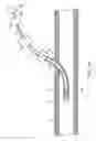 Fig. 35 - Apparatus for vessel access closure