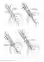 Fig. 03 - Prosthetic valve for transluminal delivery