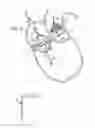 Fig. 05 - Prosthetic valve for transluminal delivery
