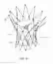 Fig. 17 - Prosthetic valve for transluminal delivery