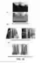 Fig. 12 - LOCAL ADVERTISING CONTENT ON AN INTERACTIVE HEAD-MOUNTED EYEPIECE