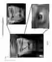 Fig. 78 - LOCAL ADVERTISING CONTENT ON AN INTERACTIVE HEAD-MOUNTED EYEPIECE