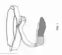 Fig. 02 - Handle Attachment