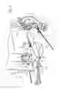 Fig. 06 - ARM PITCHING MACHINE HAVING IMPROVED BALL DELIVERY ASSEMBLY AND PITCHING ARM