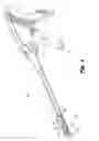 Fig. 02 - Structure for attachment of buttress material to anvils and cartridges of surgical stapler