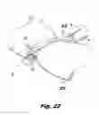 Fig. 07 - Structure for attachment of buttress material to anvils and cartridges of surgical stapler