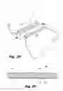 Fig. 09 - Structure for attachment of buttress material to anvils and cartridges of surgical stapler