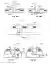 Fig. 06 - Securement of Laparoscopic Instruments on the Sterile Surgical Field