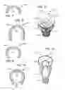 Fig. 04 - Solid state lamp with thermal spreading elements and light directing optics