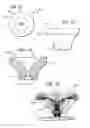 Fig. 08 - Solid state lamp with thermal spreading elements and light directing optics