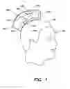 Fig. 02 - METHODS AND APPARATUS FOR ASSESSING HEAD TRAUMA BASED ON CONFORMAL SENSING OF FORCE AND/OR CHANGE IN MOTION OF A PERSON'S HEAD