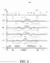 Fig. 04 - Systems and methods for sliding convolution interpolating filters