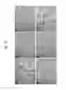 Fig. 16 - Method for preparing microspheres and microspheres produced thereby