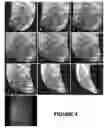 Fig. 05 - Development of a human colloidal bone graft material