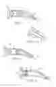 Fig. 02 - DEVICE FOR SUPPLYING A DENTAL RETRACTION CORD, A METHOD OF MAKING AND USING SUCH A DEVICE, AND A METHOD FOR GINGIVAL RETRACTION