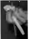 Fig. 06 - WRITING INSTRUMENT GRIPPING AID