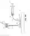 Fig. 88 - Methods and apparatus for measuring analytes using large scale FET arrays