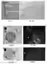 Fig. 02 - Methods and compositions to support tissue integration and inosculation of transplanted tissue and transplanted engineered penile tissue with adipose stromal cells