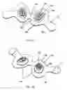 Fig. 02 - NASAL DEVICES, SYSTEMS AND METHODS