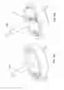 Fig. 22 - NASAL DEVICES, SYSTEMS AND METHODS