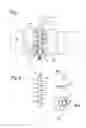 Fig. 02 - Respiration detecting arrangement