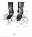 Fig. 03 - DEVICE FOR MEASURING THE ROTATIONAL INSTABILITY OF THE KNEE
