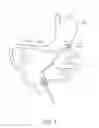 Fig. 02 - APPARATUS AND METHOD FOR GASTRIC BYPASS SURGERY