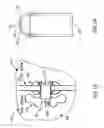 Fig. 02 - DEVICE AND METHOD FOR CONTROLLING IN-VIVO PRESSURE
