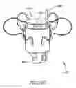 Fig. 22 - DEVICE AND METHOD FOR CONTROLLING IN-VIVO PRESSURE