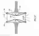 Fig. 03 - DEVICE AND METHOD FOR CONTROLLING IN-VIVO PRESSURE