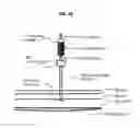 Fig. 09 - Insertion indicator for needle