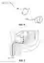 Fig. 03 - Systems and Methods for Implanting Devices in the Bladder and Other Genitourinary Sites