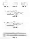 Fig. 06 - Systems and Methods for Implanting Devices in the Bladder and Other Genitourinary Sites