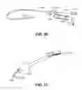 Fig. 09 - Systems and Methods for Implanting Devices in the Bladder and Other Genitourinary Sites