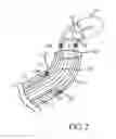 Fig. 09 - Catheter with pull wire measurement feature