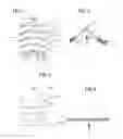 Fig. 02 - DEVICE FOR INJECTING FLUID FOR MEDICAL USE
