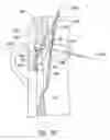 Fig. 07 - SYSTEMS AND METHODS FOR TRANSEPTAL CARDIAC PROCEDURES, INCLUDING ADJUSTABLE, SEPARABLE GUIDEWIRES